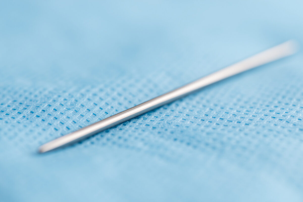 Broche qui ressort : urgence ou normalité ?