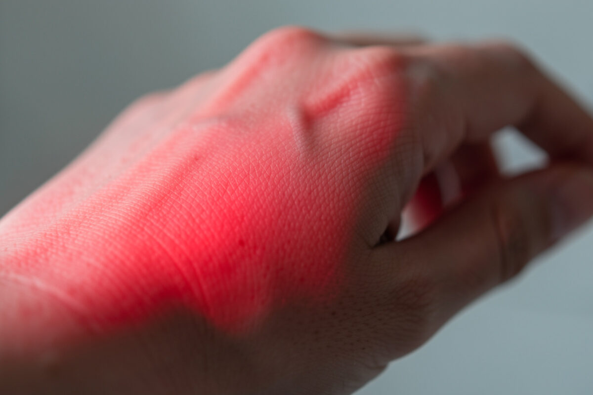 Photobiomodulation : la lumière qui répare vos cellules